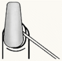 Removed from Edge